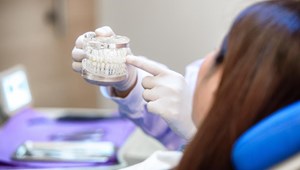 ¿Qué ventajas presentan los implantes dentales?