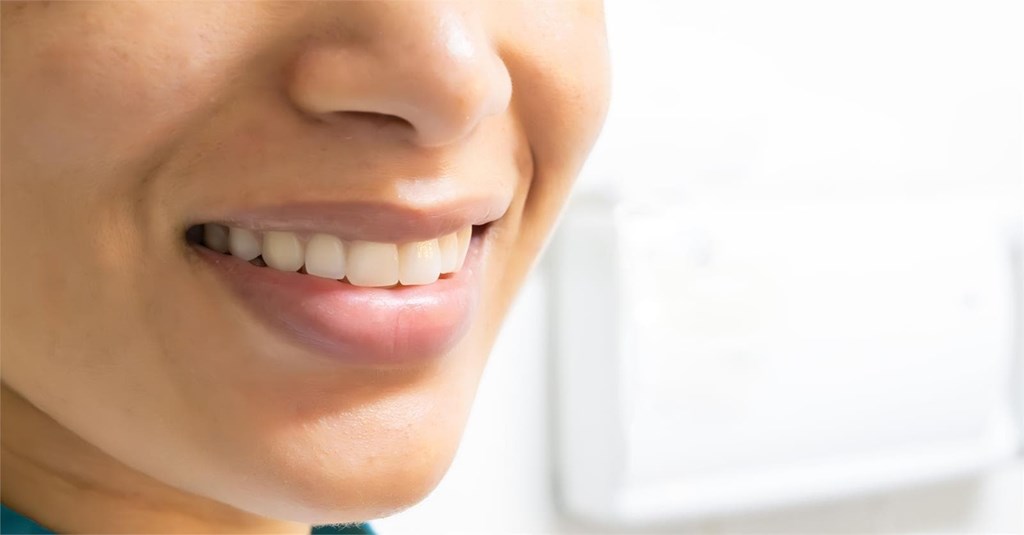 5 preguntas que puedes hacerle a nuestros dentistas en Vigo y Baiona antes de ponerte un implante dental