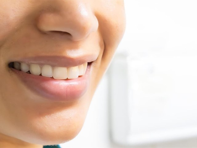 5 preguntas que puedes hacerle a nuestros dentistas en Vigo y Baiona antes de ponerte un implante dental