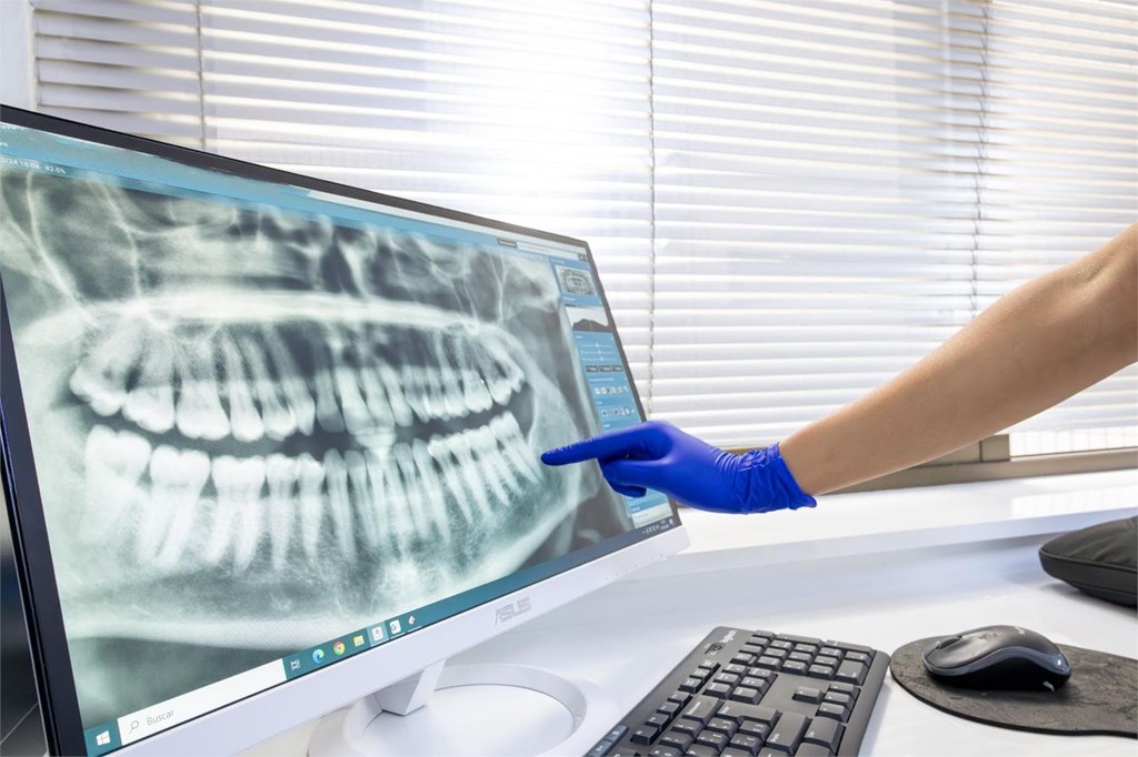 6 señales de que tu hijo necesita una valoración ortodóncica con nuestros dentistas en Vigo y Baiona