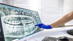 6 señales de que tu hijo necesita una valoración ortodóncica con nuestros dentistas en Vigo y Baiona