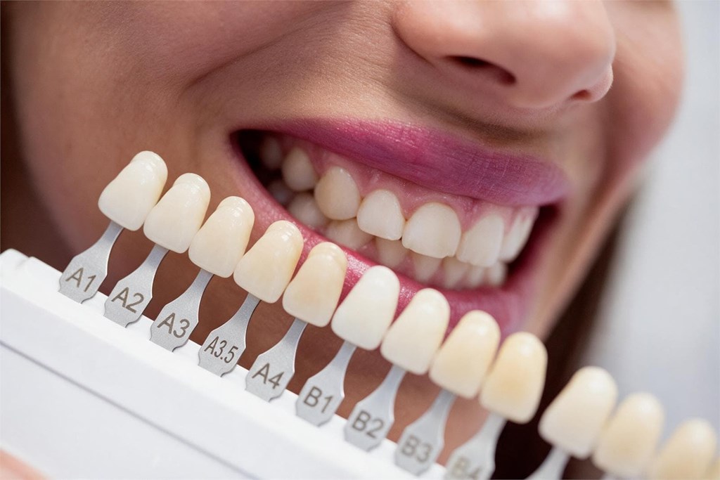 ¿A qué edad se puede hacer un blanqueamiento dental sin riesgo?
