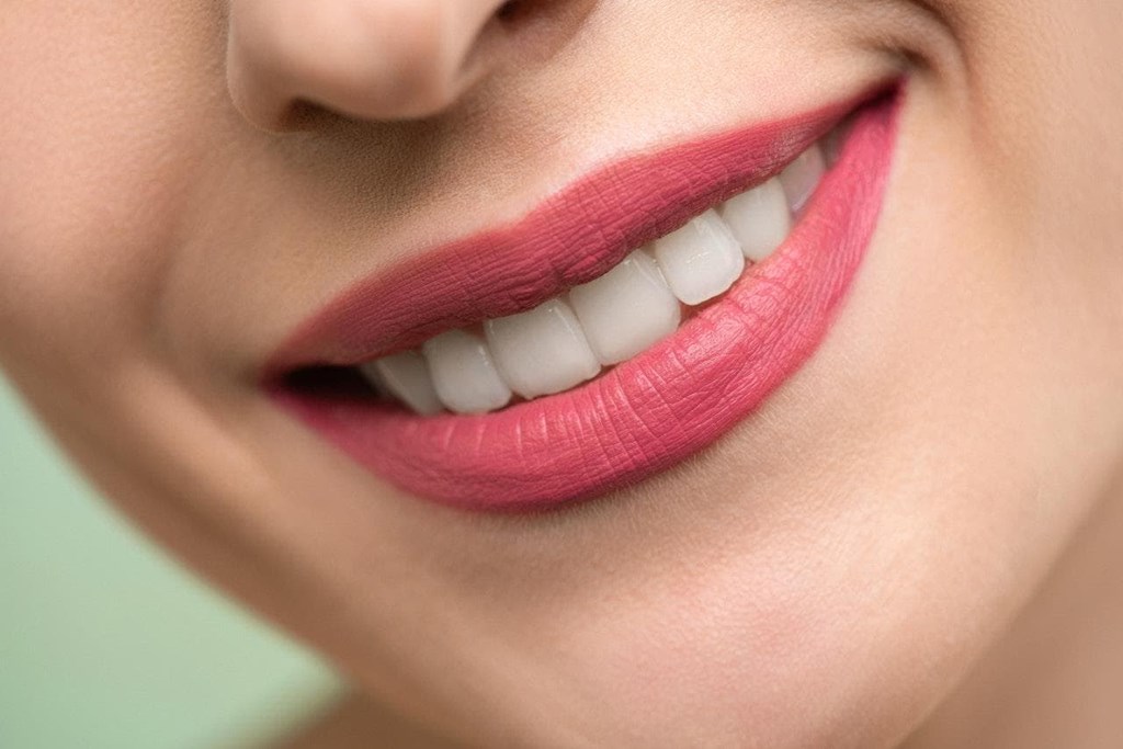 Carillas dentales de porcelana: características y ventajas dentro de la estética dental