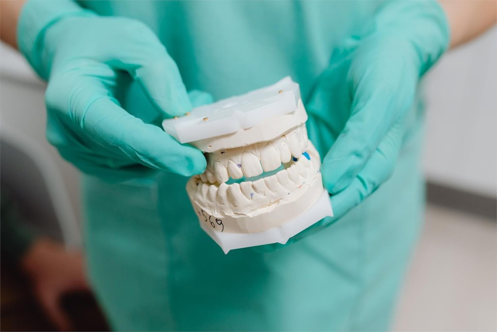 ¿Cómo cuidar los implantes dentales?