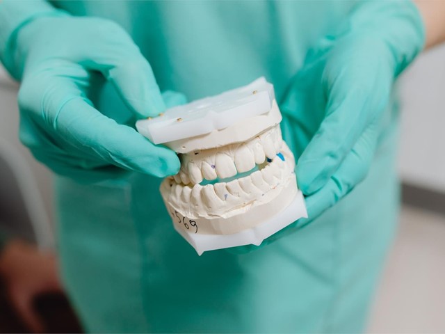 ¿Cómo cuidar los implantes dentales?