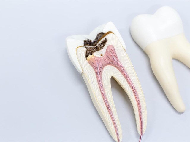 ¿Cómo podemos prevenir la pérdida de piezas dentales?