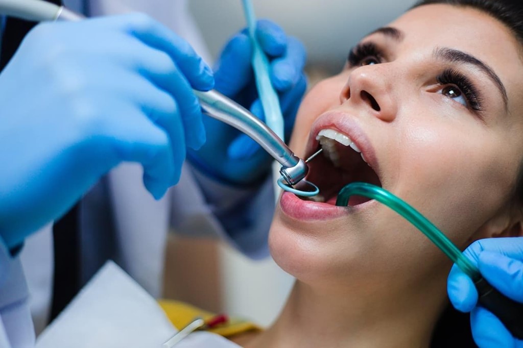 ¿Cuándo es necesaria una endodoncia?