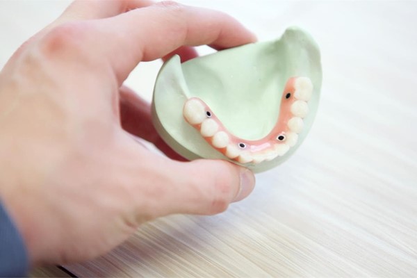 ¿Cuánto cuesta un implante dental?