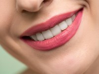 ¿Cuánto dura un tratamiento de blanqueamiento dental?