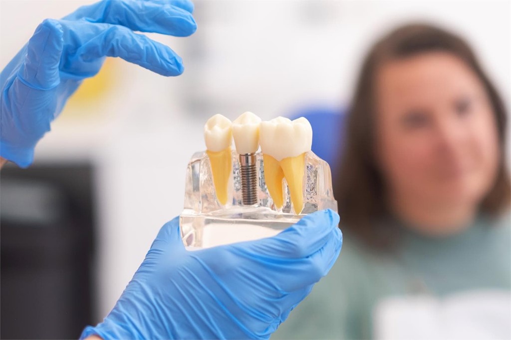 ¿Cuántos tipos de implantes dentales existen?