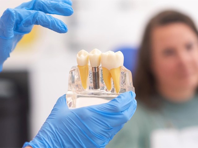 ¿Cuántos tipos de implantes dentales existen?