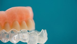 ¿Es posible corregir el alineamiento dental sin usar brackets tradicionales?