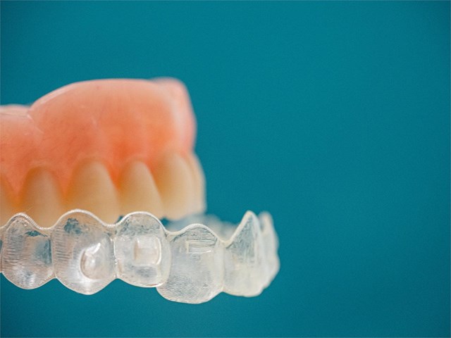 ¿Es posible corregir el alineamiento dental sin usar brackets tradicionales?
