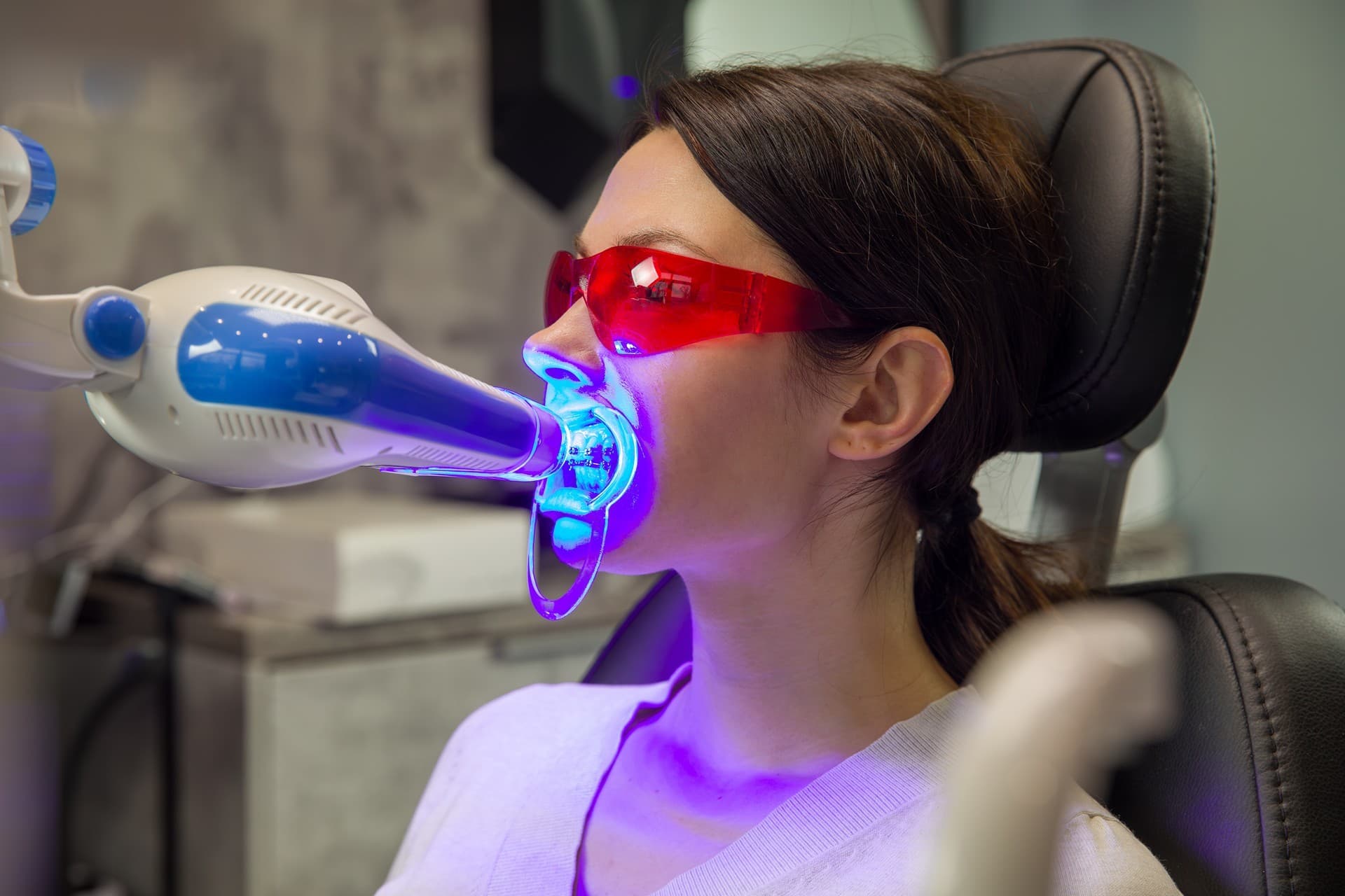 Blanqueamiento dental en Vigo y Baiona