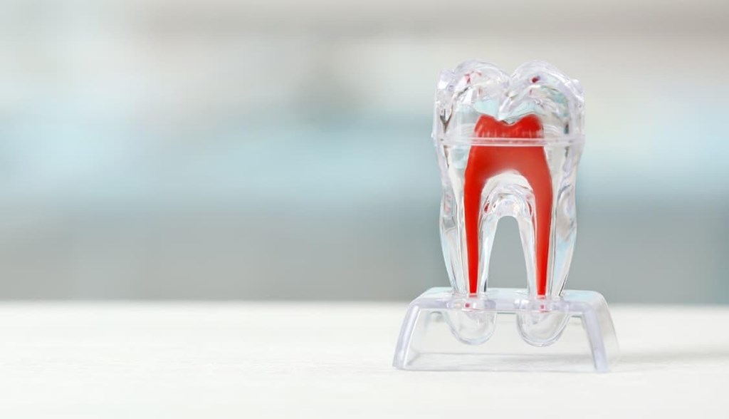¿Las endodoncias duelen? 