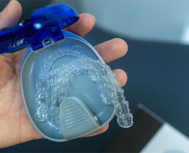 ¿Qué alimentos y bebidas debo evitar si tengo brackets?