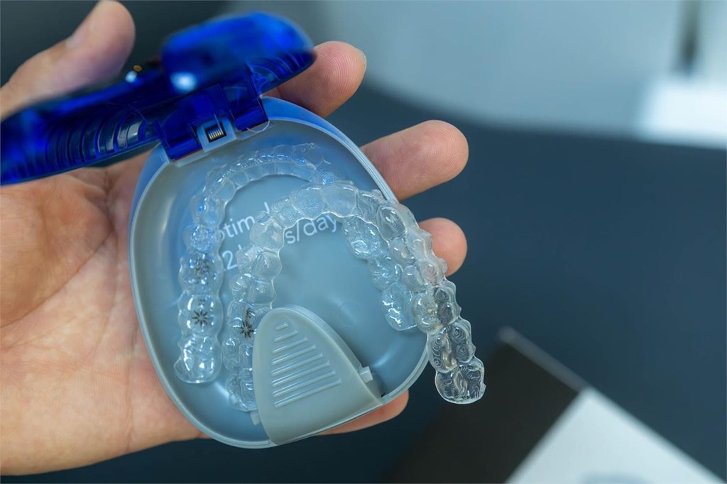 ¿Qué alimentos y bebidas debo evitar si tengo brackets?