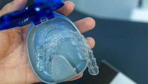 ¿Qué alimentos y bebidas debo evitar si tengo brackets?