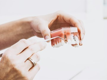 ¿Qué es y cómo se hace un implante dental?