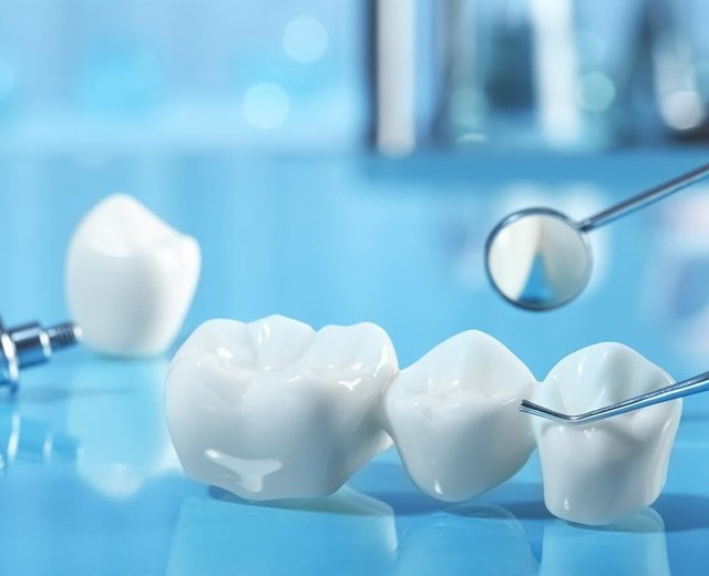 ¿Qué son las coronas dentales y cuándo son necesarias?