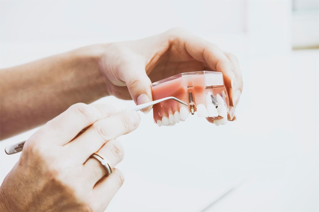 ¿Qué tipo de anestesia se utiliza para colocar implantes dentales?