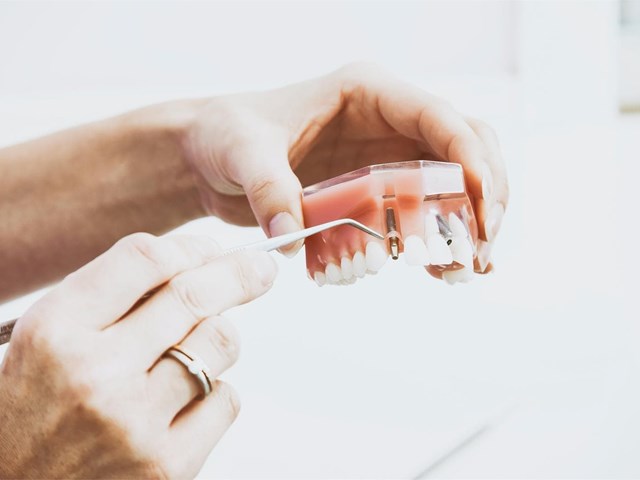 ¿Qué tipo de anestesia se utiliza para colocar implantes dentales?