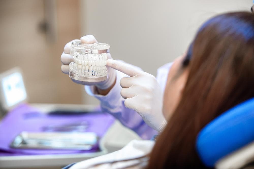 ¿Qué ventajas presentan los implantes dentales?