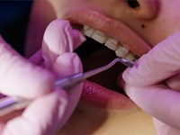 Tipos de ortodoncia: características principales de cada uno de ellos