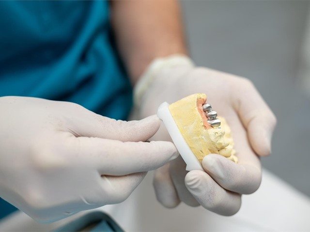 Tipos y características de implantes dentales