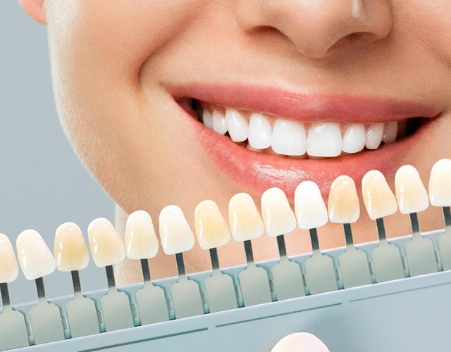 Tratamientos de blanqueamiento dental en Vigo y Baiona