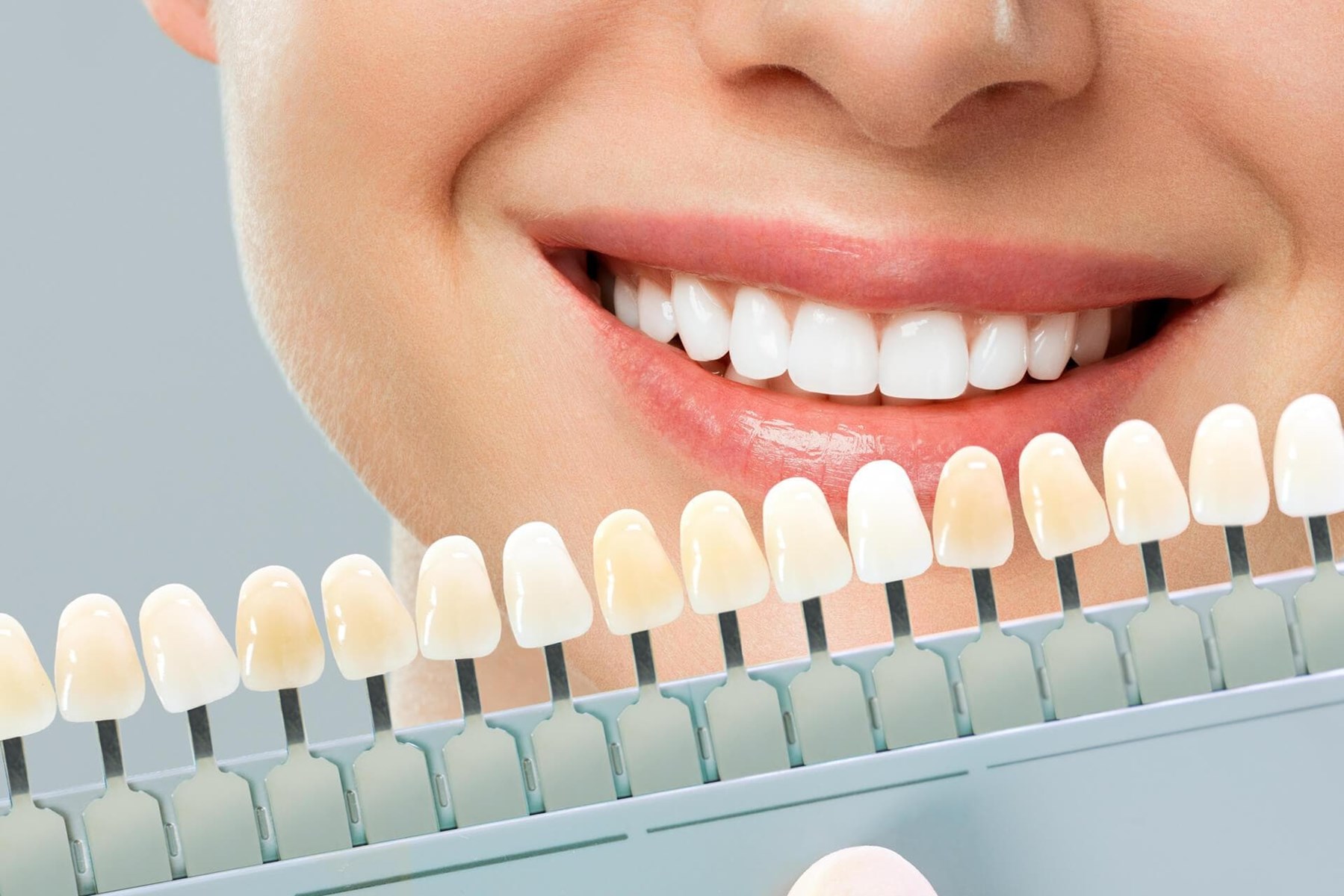 Tratamientos de estética dental en Vigo y Baiona