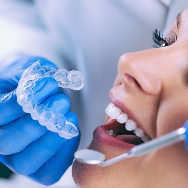 Tratamientos de ortodoncia invisible