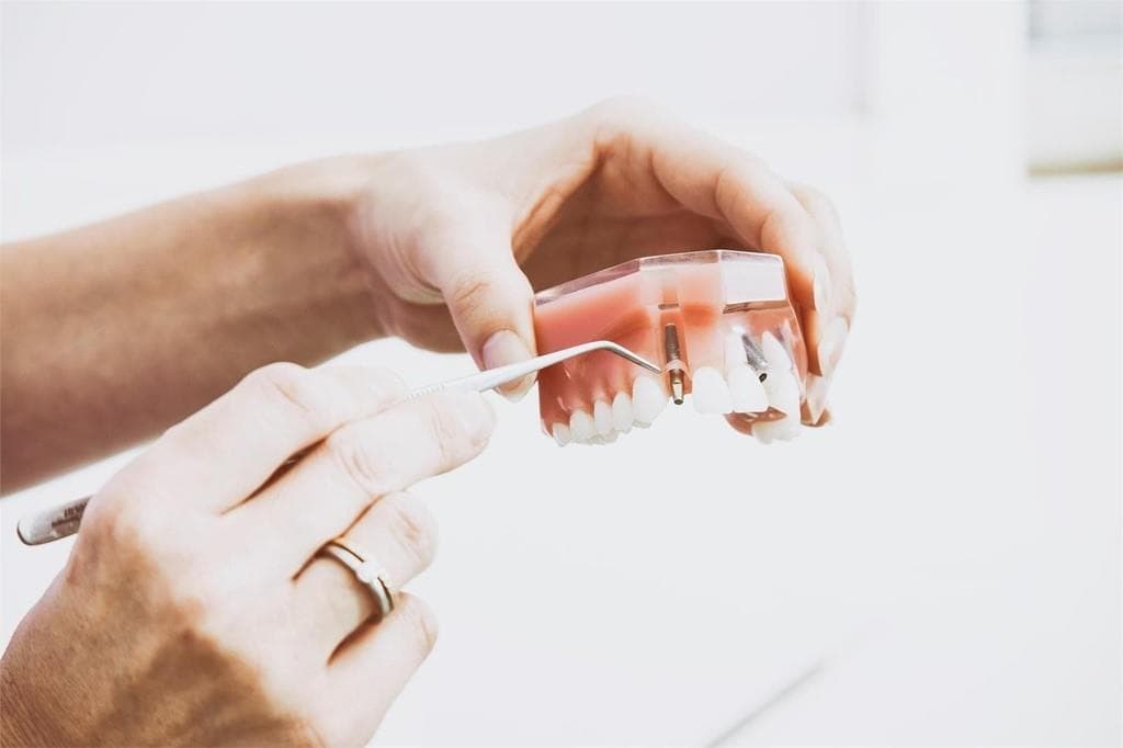 Tus implantes dentales en Vigo y Baiona al mejor precio